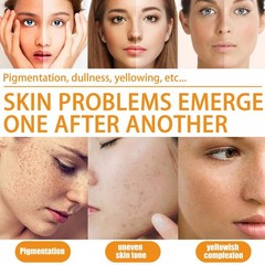 Vitamin C Serum for Face Whitening Facial Serum Hyaluronic Acid Dark Spot Remove