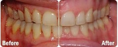 ProBiora Oral-Care Chewable Probiotic Tablets | Probiotic Supplement for Wome…