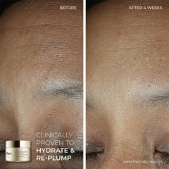 RoC Retinol Correxion Eye Cream & Night Serum Capsules – Anti-Aging Treatment