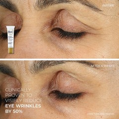 RoC Retinol Correxion Eye Cream & Night Serum Capsules – Anti-Aging Treatment