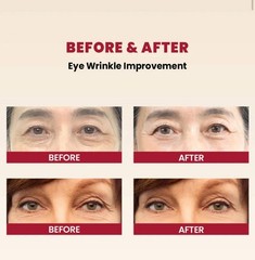 KSECRET SEOUL 1988 Eye Cream: Retinal Liposome 4% + Fermented Bean