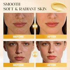 Bee Venom Cream – Natural Bee Venom Skin Treatment Cream,Anti-Aging, Firming &