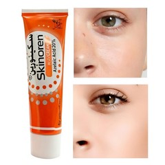 SkinorenAzelaic Acid 20% Anti AcneTreatment Personal Skin Care
