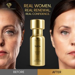 NAD+ Anti-Aging Serum – Boost Cellular Energy, Firm Skin & Reduce Wrinkles – wit